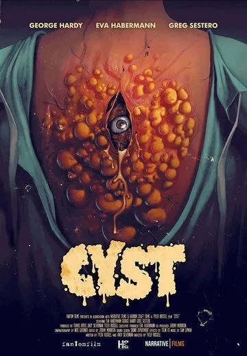 Постер: Киста / Cyst (2020)