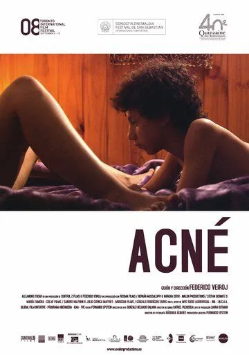 Постер: Угри / Acné (2008)